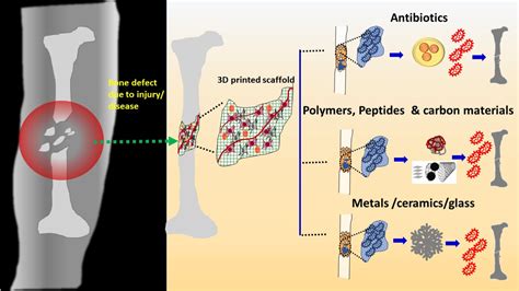 Alginat für innovative Wundauflagen und biologisch abbaubare Tissue Engineering-Gerüste!